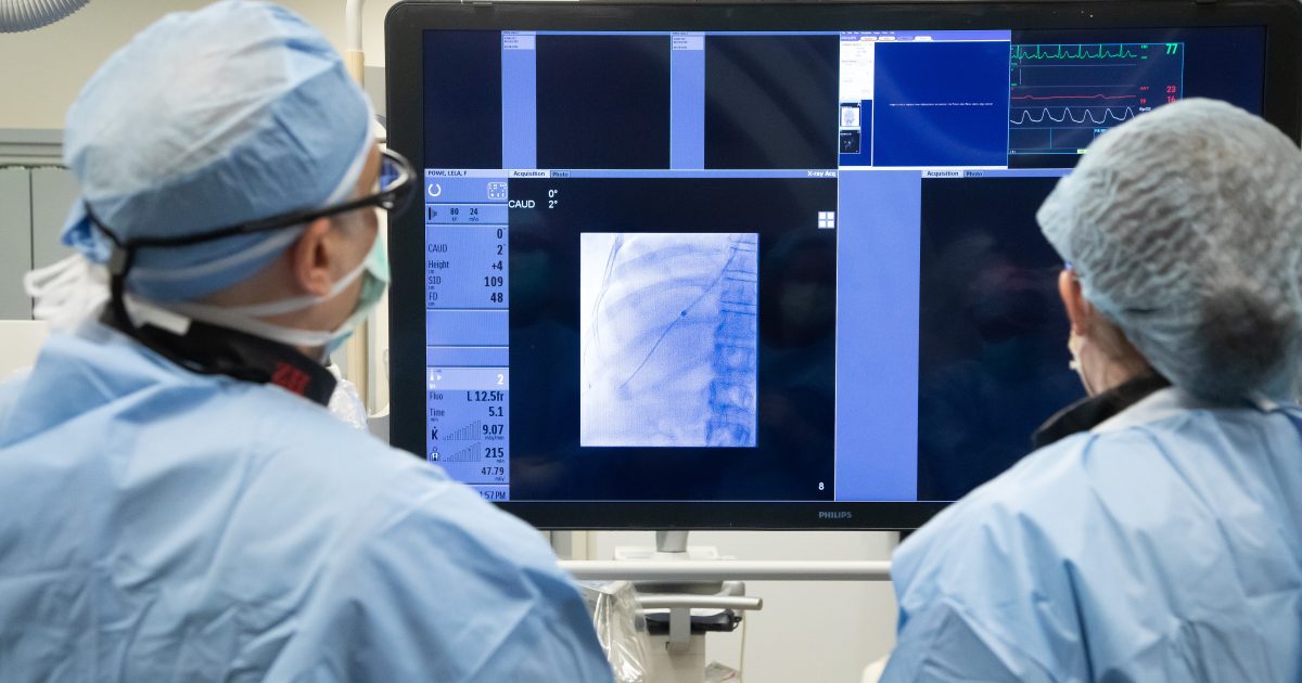 Fibroid Embolization Near Me A Minimally Invasive Treatment Option