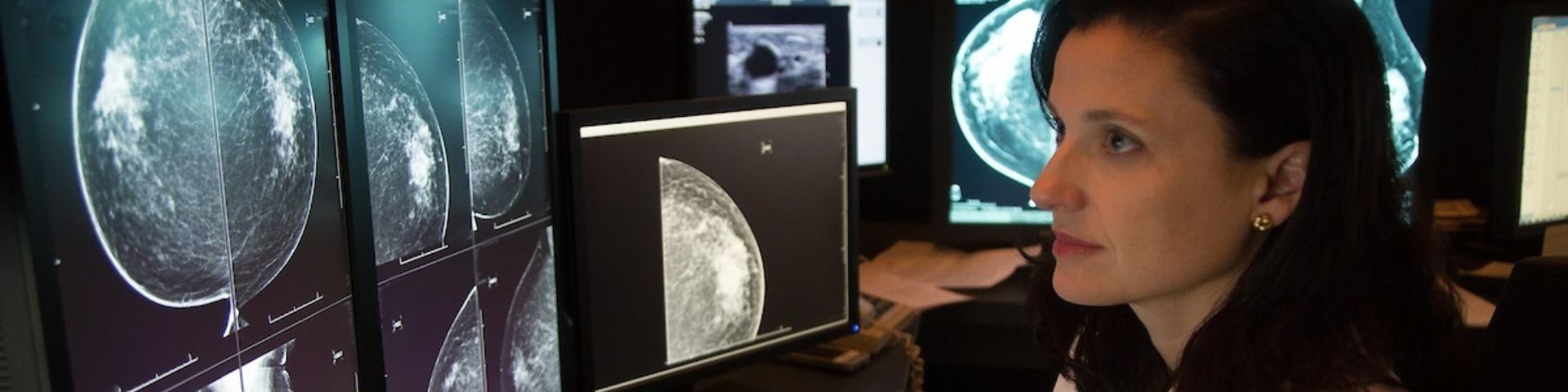 Mammography - USA Health