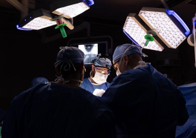 Dr. Tyler McDonald, pediatric orthopaedic surgeon and an assistant professor of orthopaedic surgery, center, and Dr. Richard Menger, chief of complex spine surgery and associate professor of neurosurgery, right, perform surgery at USA Health Children’s & Women’s Hospital in August 2023 to insert pins into Abby Flowers' skull for halo gravity traction.